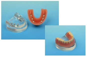Lower Denture